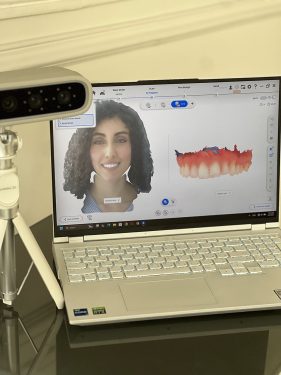 تصميم الابتسامة في عيادة القيطية لطب الأسنان