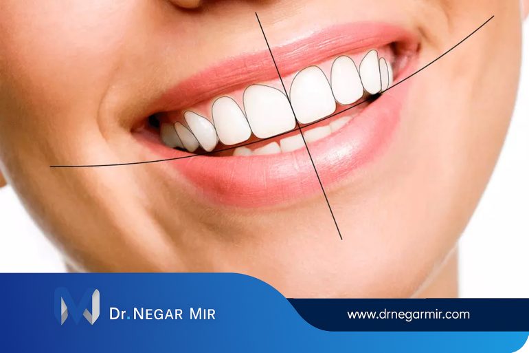 طراحی لبخند ایده آل