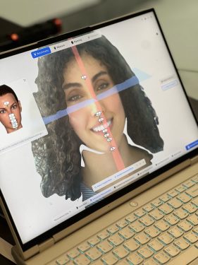 طراحی لبخند با اسکن و انالیز چهره