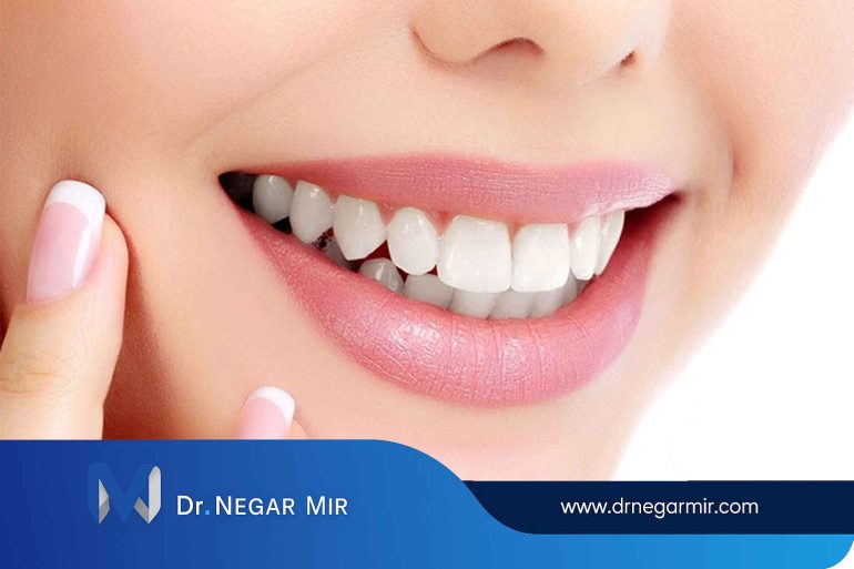 لیمنت سرامیکی در دندانپزشکی میر
