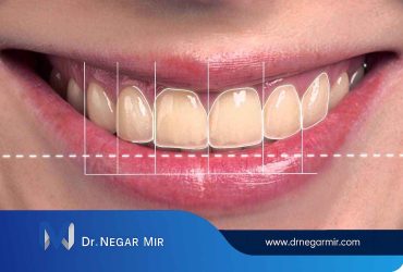 دندانپزشکی زیبایی و طراحی لبخند دیجیتال