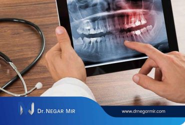 طراحی لبخند با هوش مصنوعی