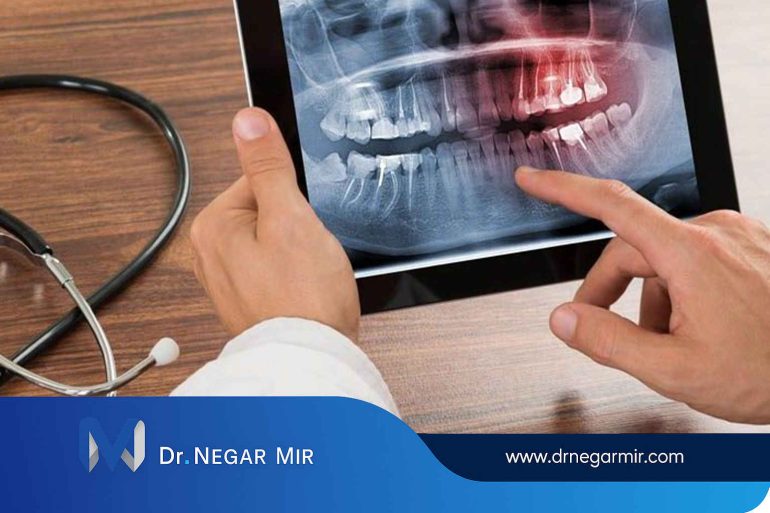 ایمپلنت دیجیتال کلینیک دکتر میر