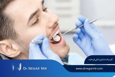 علت شکستن لمینت سرامیکی