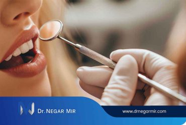 بهترین دکتر کامپوزیت ونیر