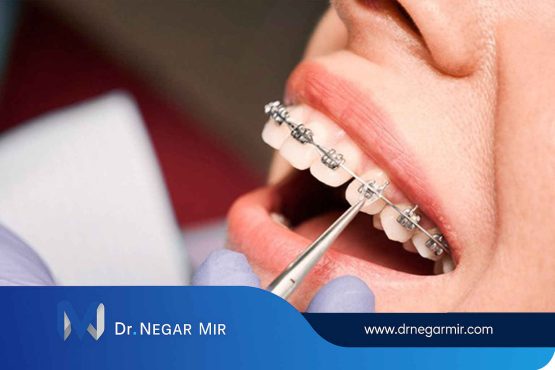  ارتودنسی دندان