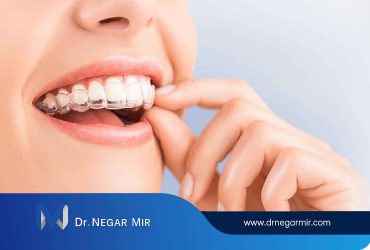 ارتودنسی شفاف