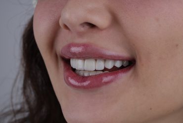 کامپوزیت پرینت شونده