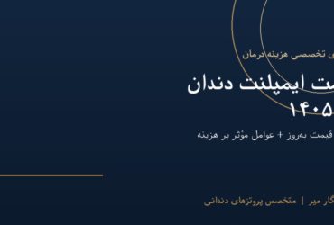 قیمت ایمپلنت دندان در 1405